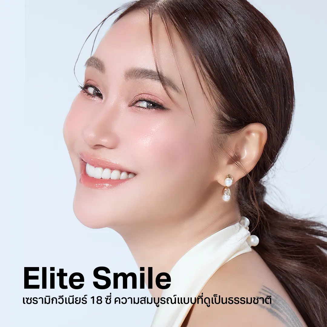 elite smile ultimate smile โปรโมชั่น วีเนียร์ 2025 ราคาเท่าไหร่ cosdent smile design