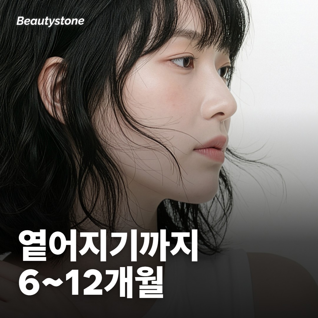 옅어지기까지 걸리는 시간을 미리 알아 두세요