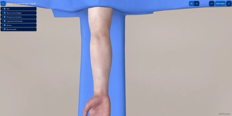 Distal biceps tendon repair