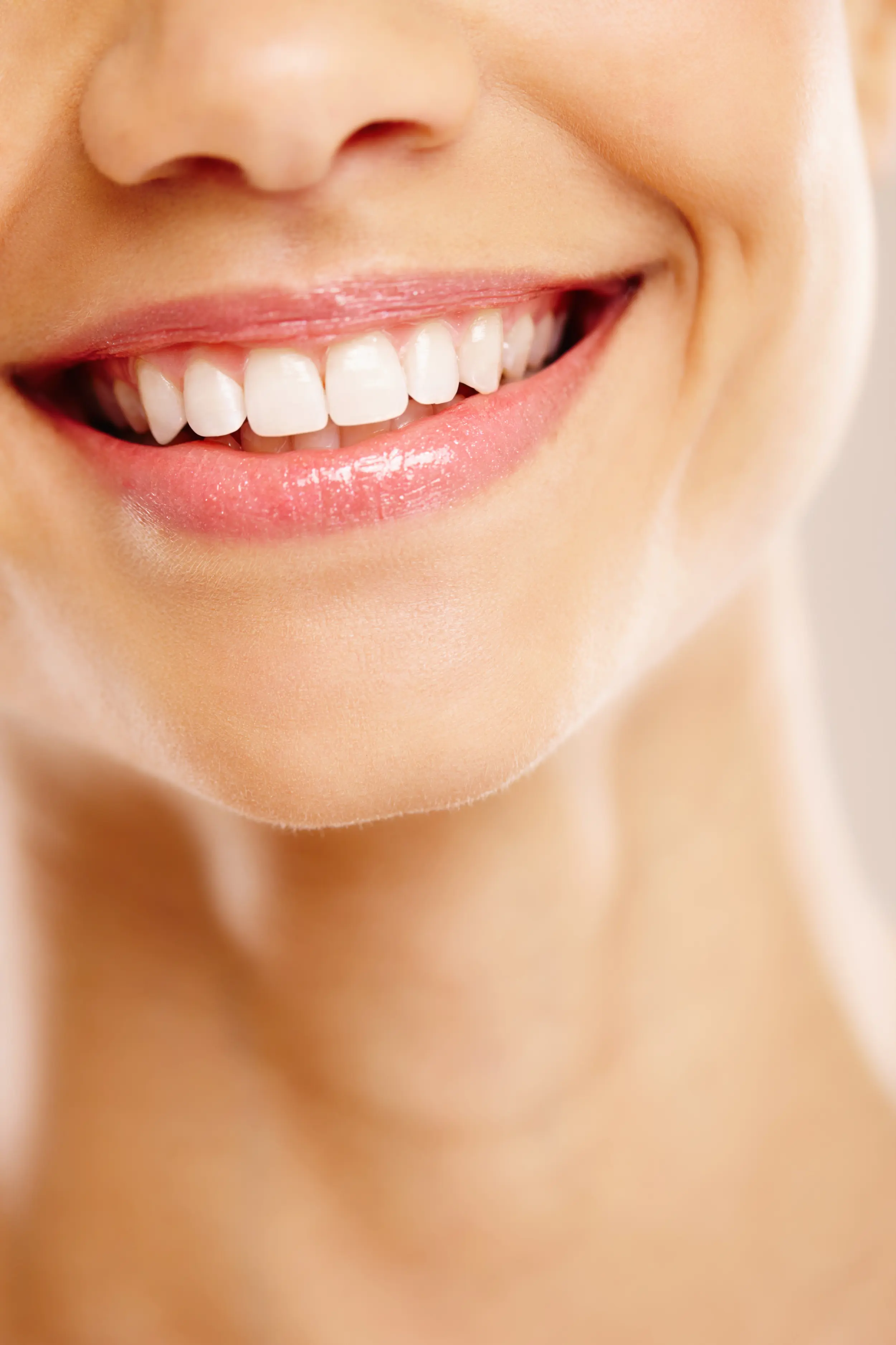 Sorriso