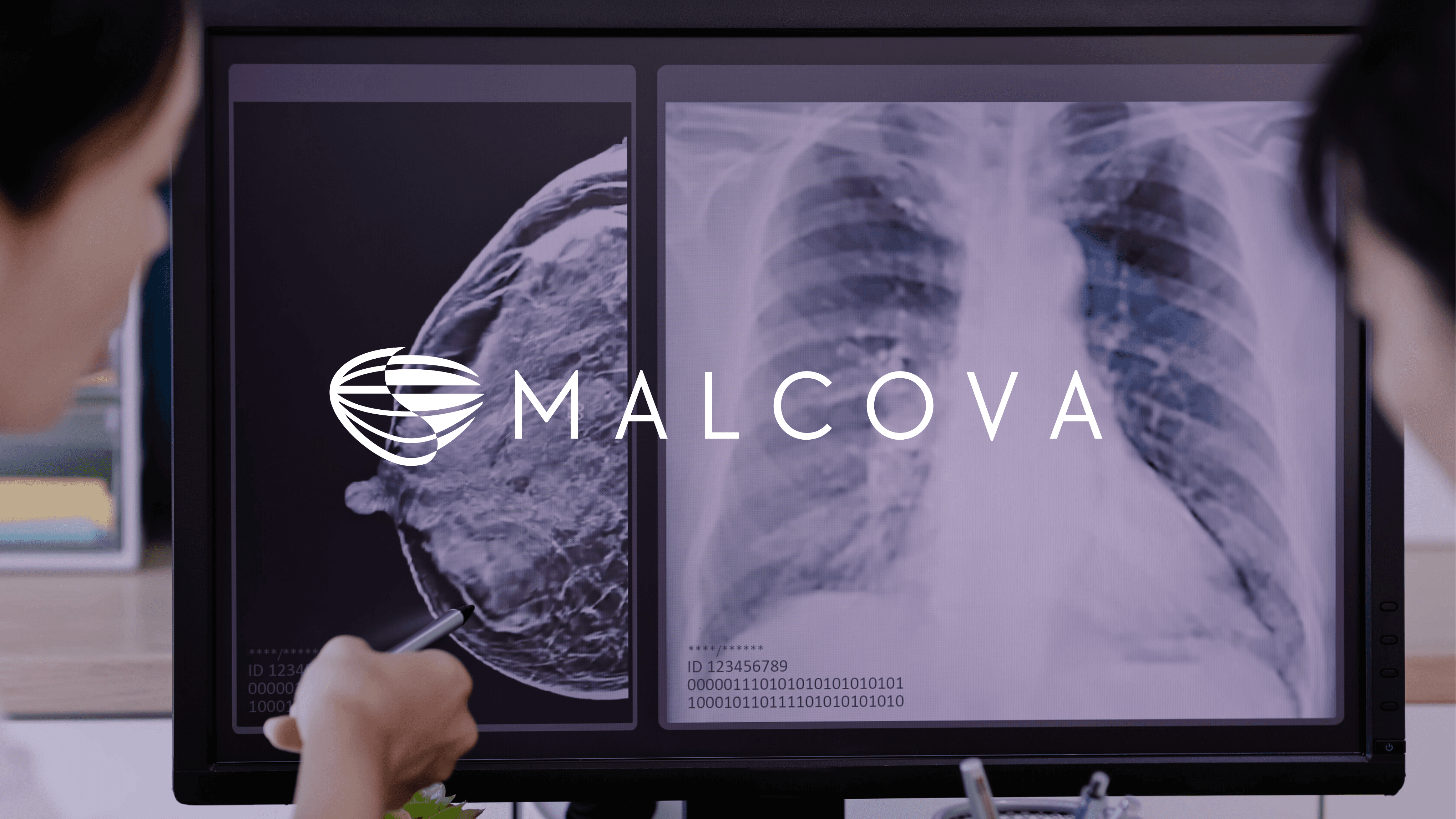 Tablet showing Bloomy UI