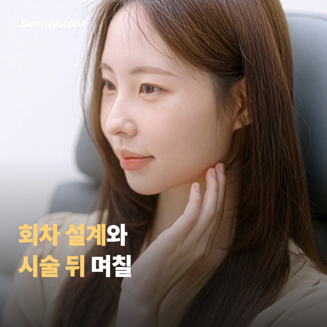 회차 설계와 시술 뒤 며칠은 어떻게 보낼까요