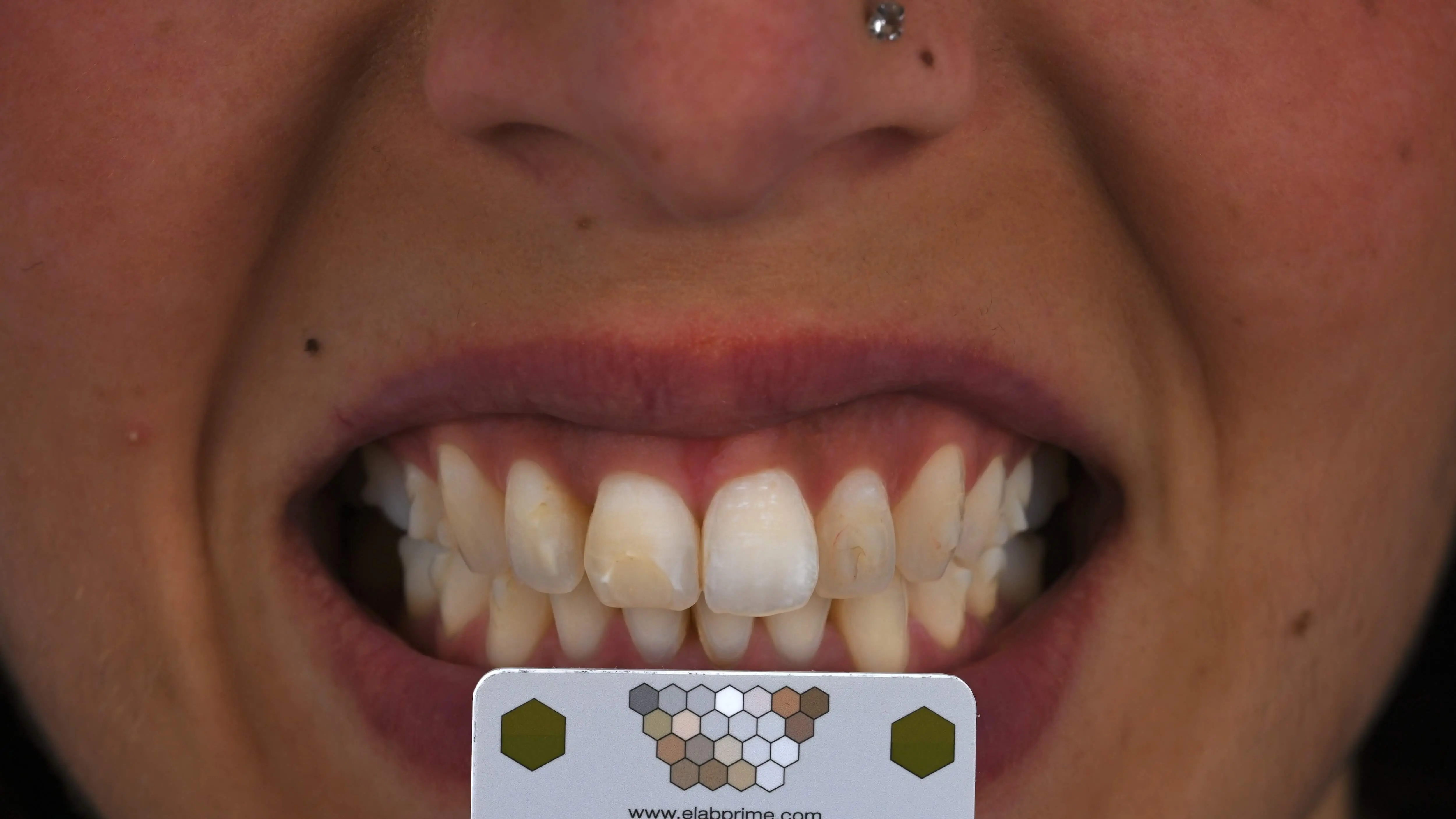 Foto mit Polarizationsfilter