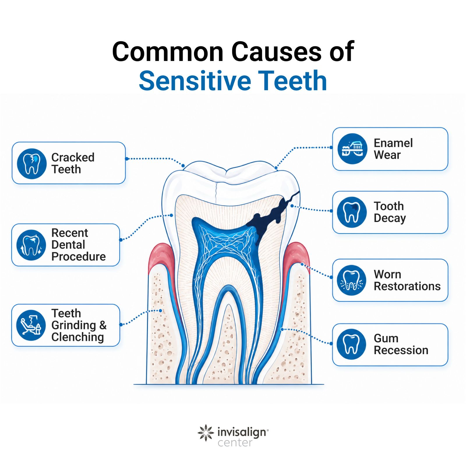 Major Causes of Sensitive Teeth