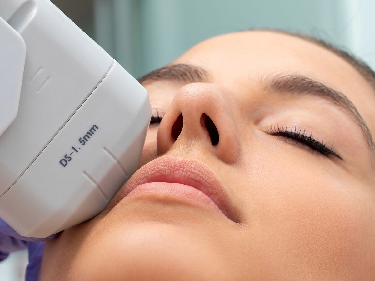 HIFU® en Terrassa, Heaven Clinics