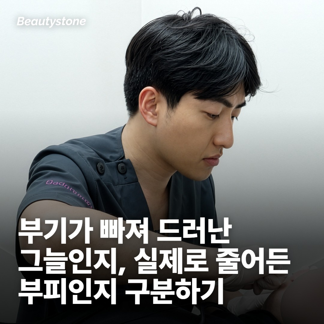 직후와 몇 주 뒤가 달라 보이는 이유