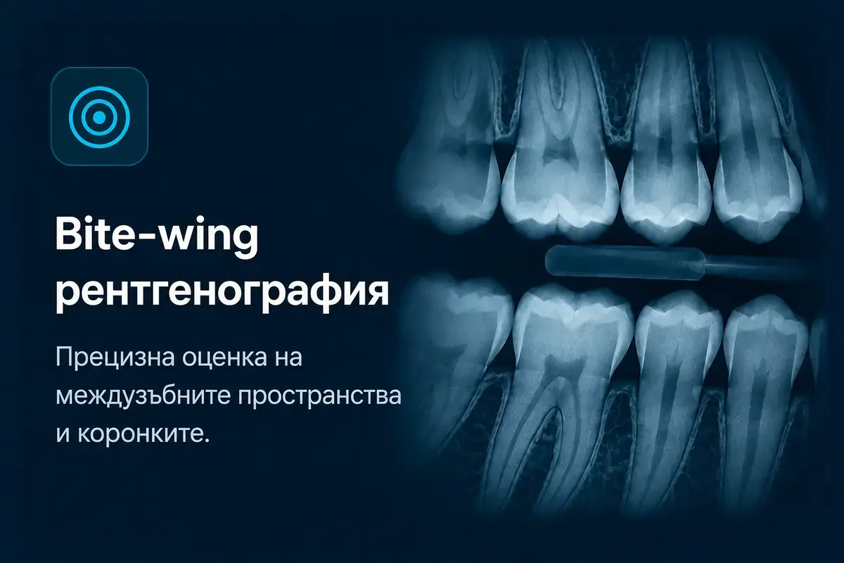 Bite-wing рентгенография – прецизна оценка на междузъбните пространства и зъбните коронки.