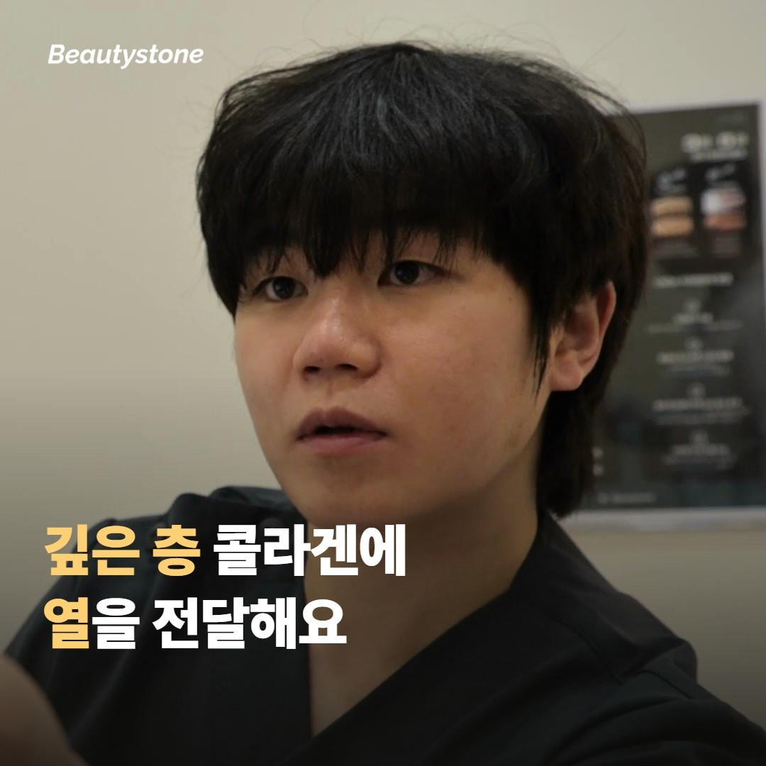 모노폴라 RF가 깊은 층에 열을 전달하는 방식