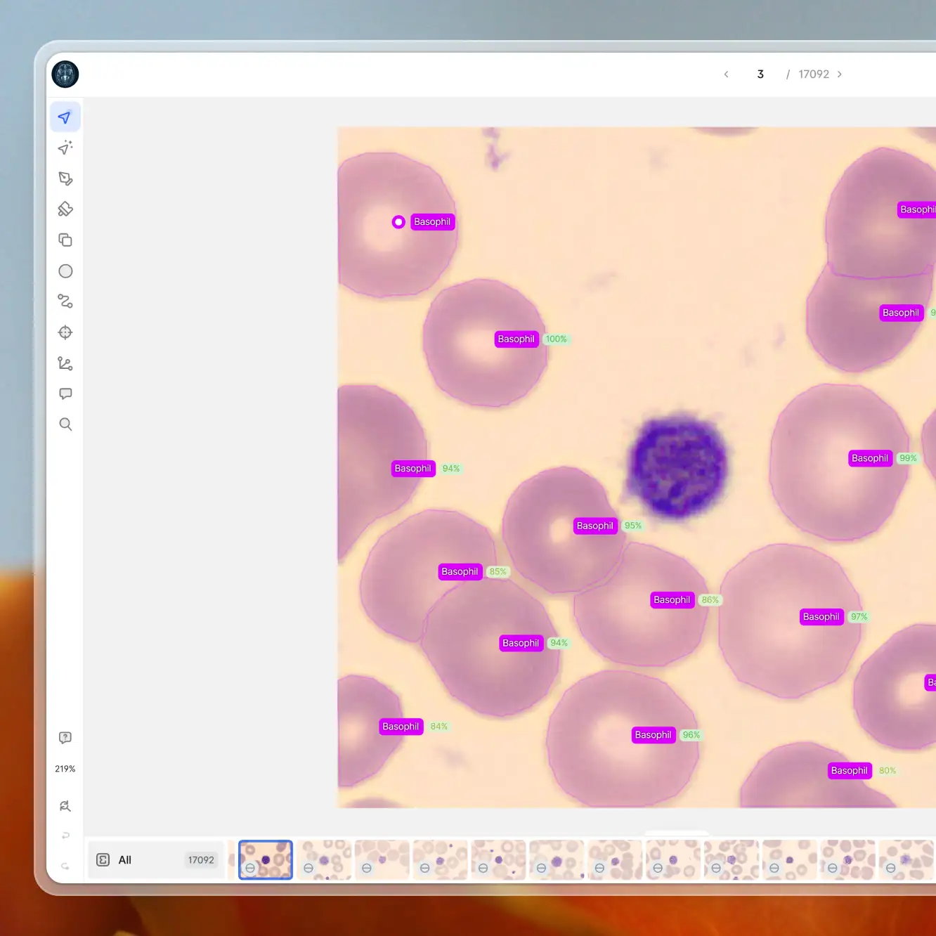 A data labeling tool where a medical image is being labeled as Basophil Cell