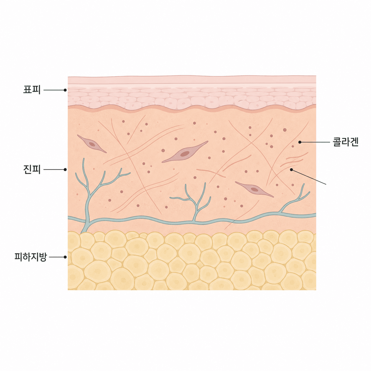 볼 진피층에서 새 콜라겐이 차오르는 단면
