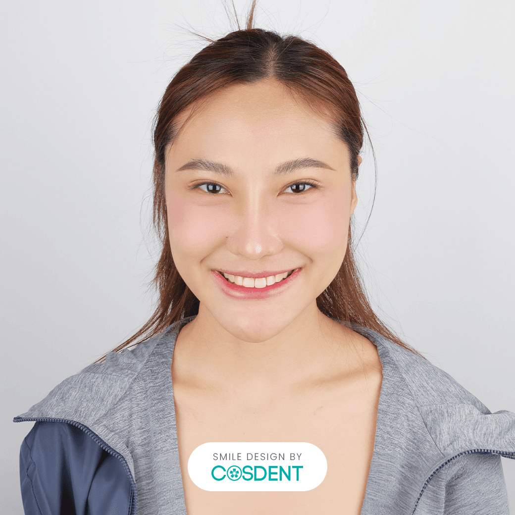 หน้าหวาน ยิ้มกว้าง 8 ซี่