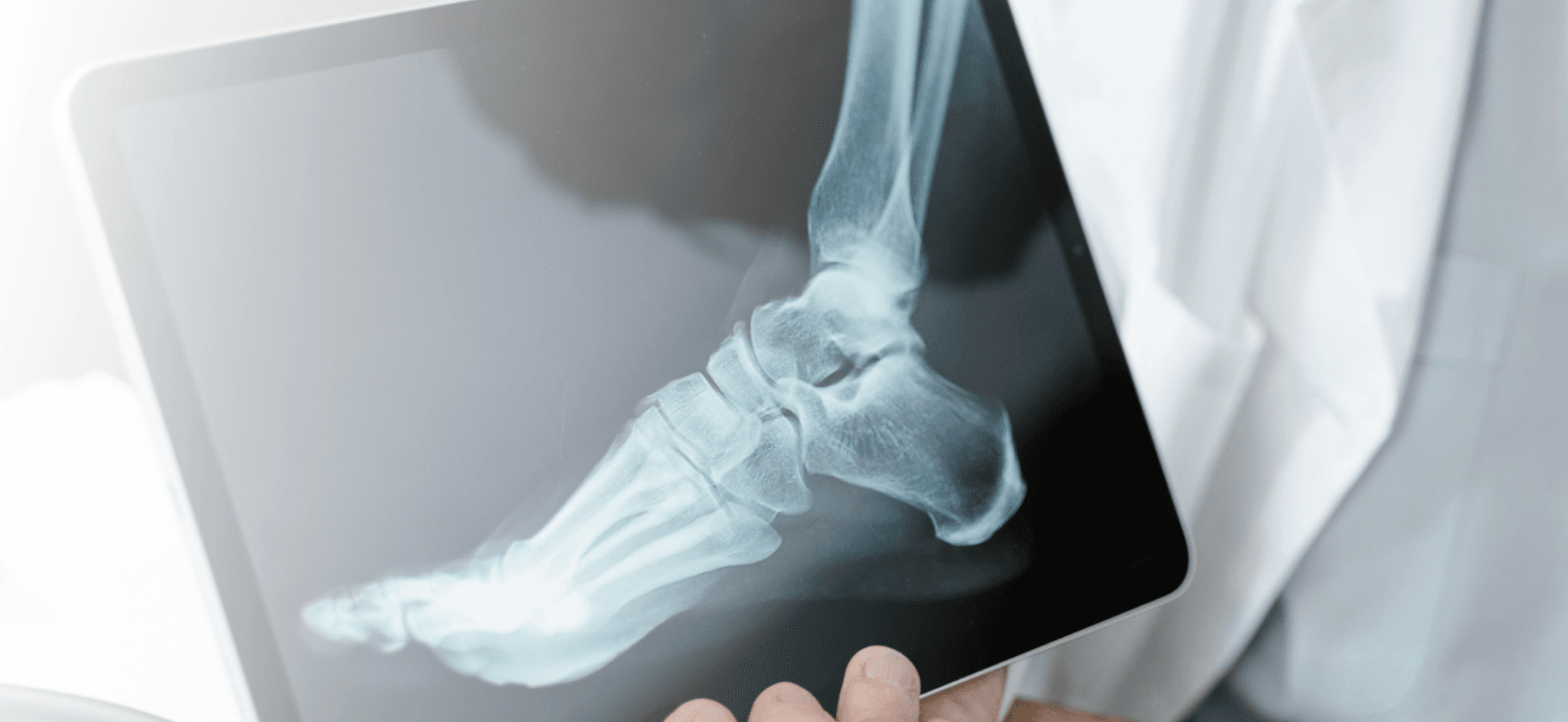 Röntgenbild eines Sprunggelenk auf einem iPad