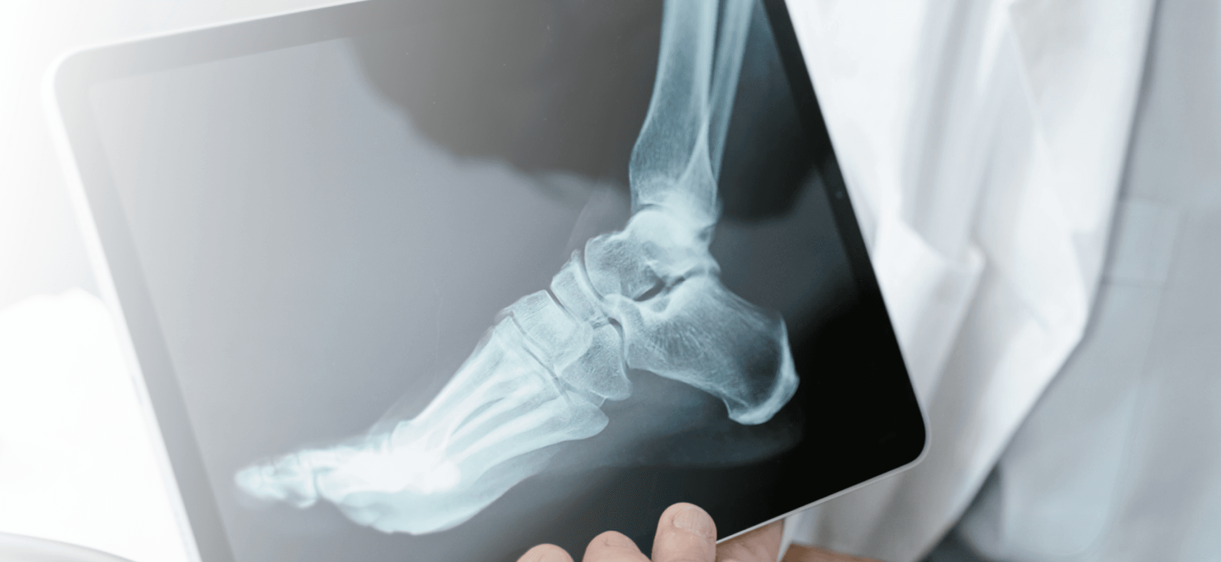 Röntgenbild eines Sprunggelenk auf einem iPad