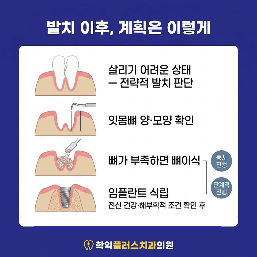발치가 필요할 때의 진행 순서 — 잇몸뼈 확인부터 뼈이식·임플란트까지