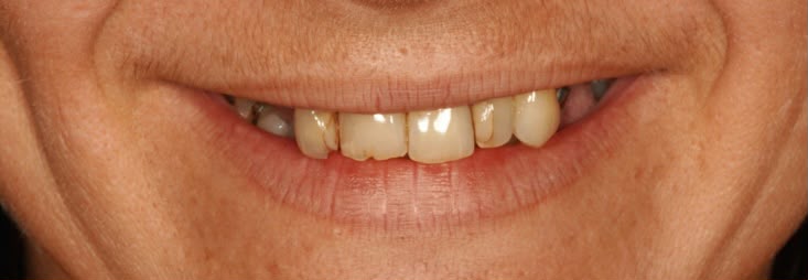 Image after