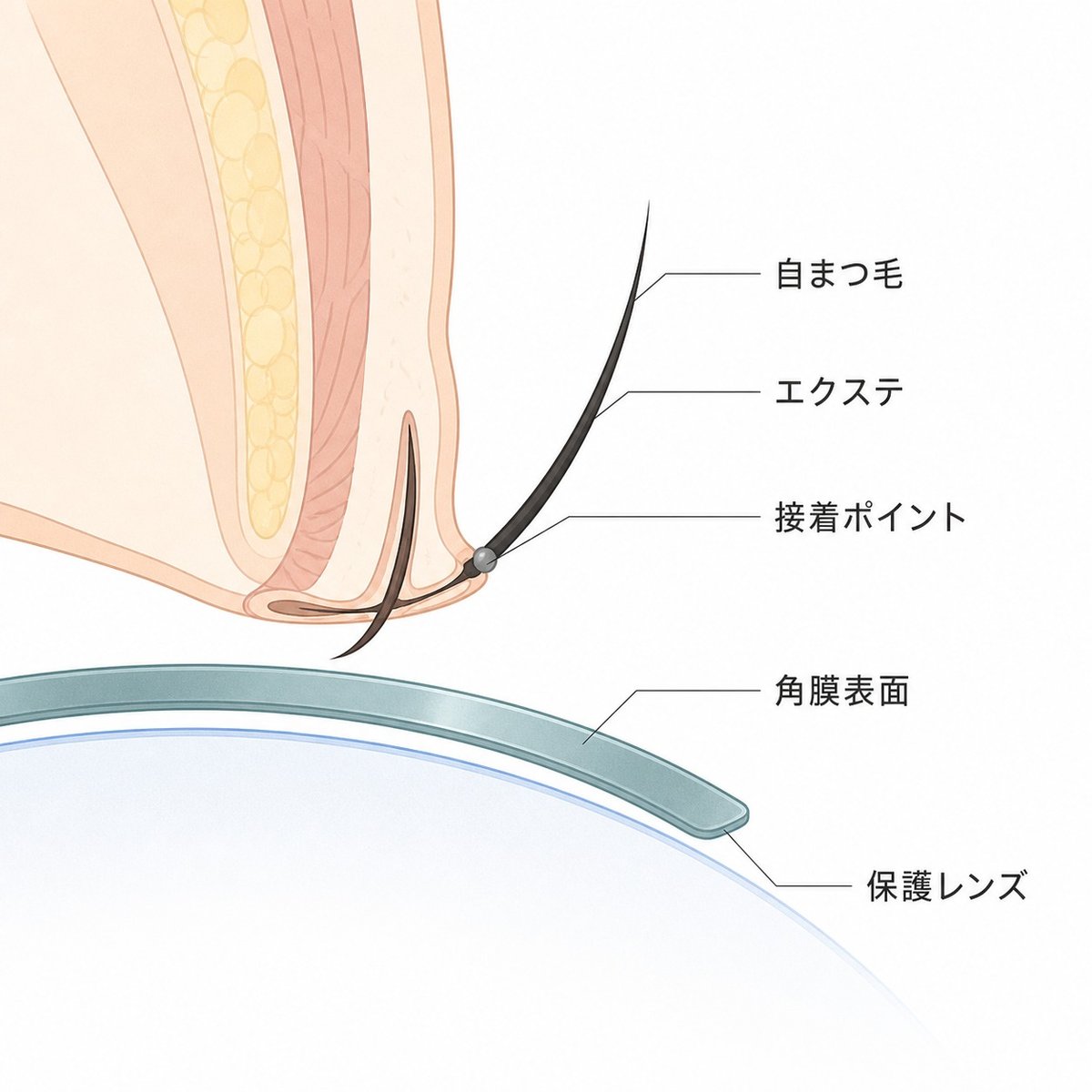 まつエクの接着位置と眼の保護レンズの関係を示した教育用断面図