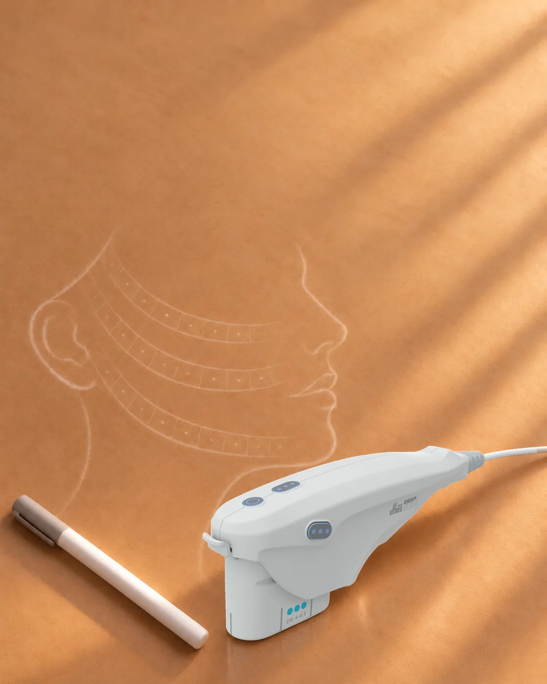 米色紙上以白筆畫的臉部輪廓與療程位置格,旁邊是Ultherapy PRIME手把