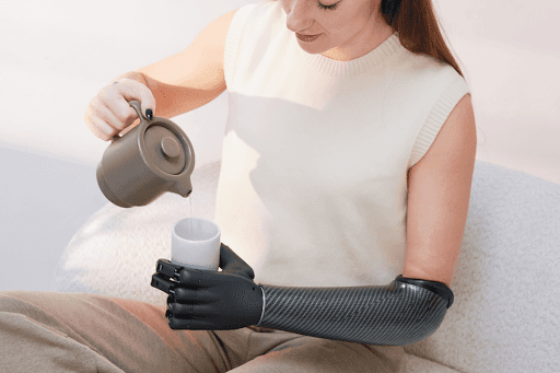 Atención protésica rentable para miembro superior con el ecosistema Zeus Hand