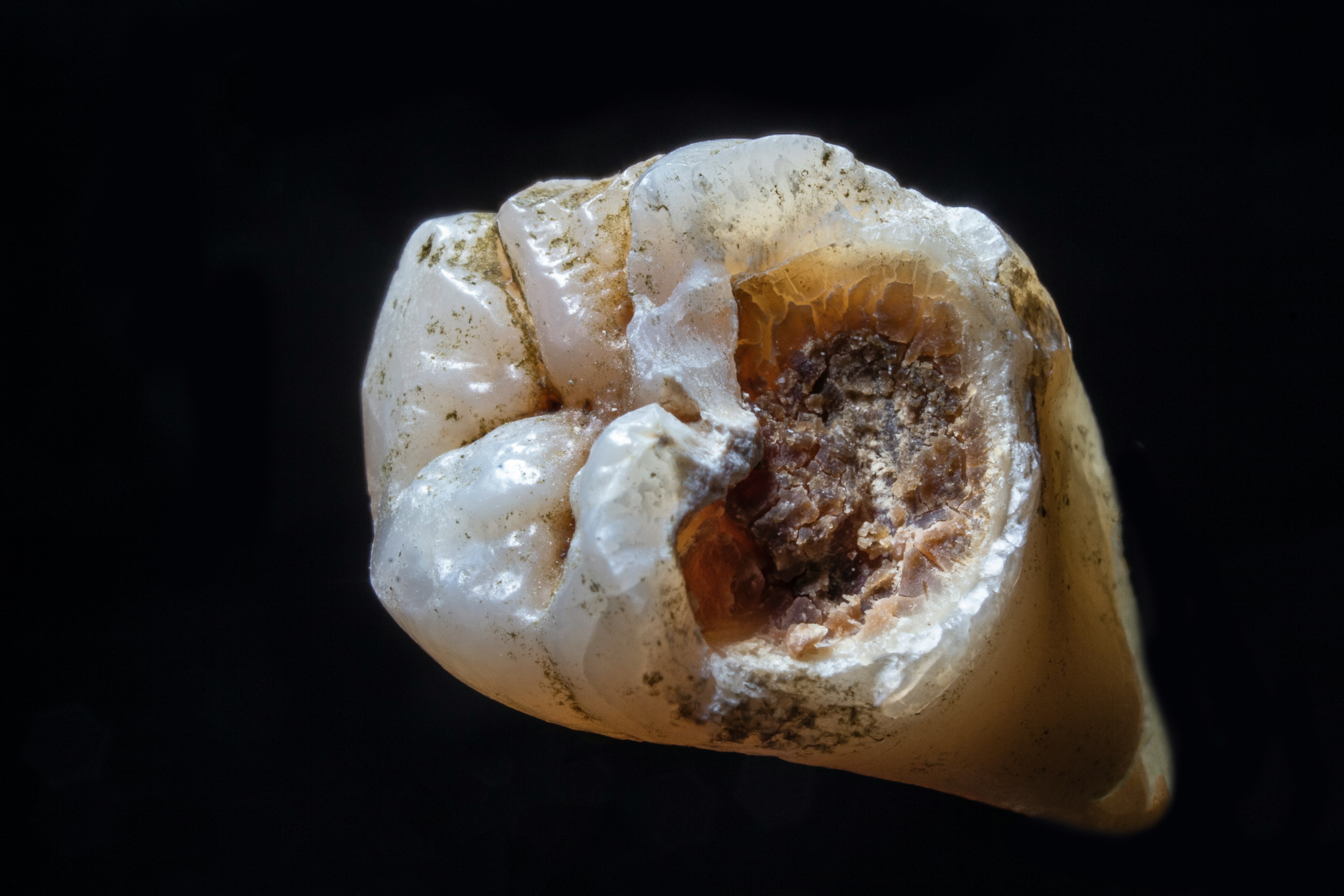 Emergency Dentist | Plainview & Mineola