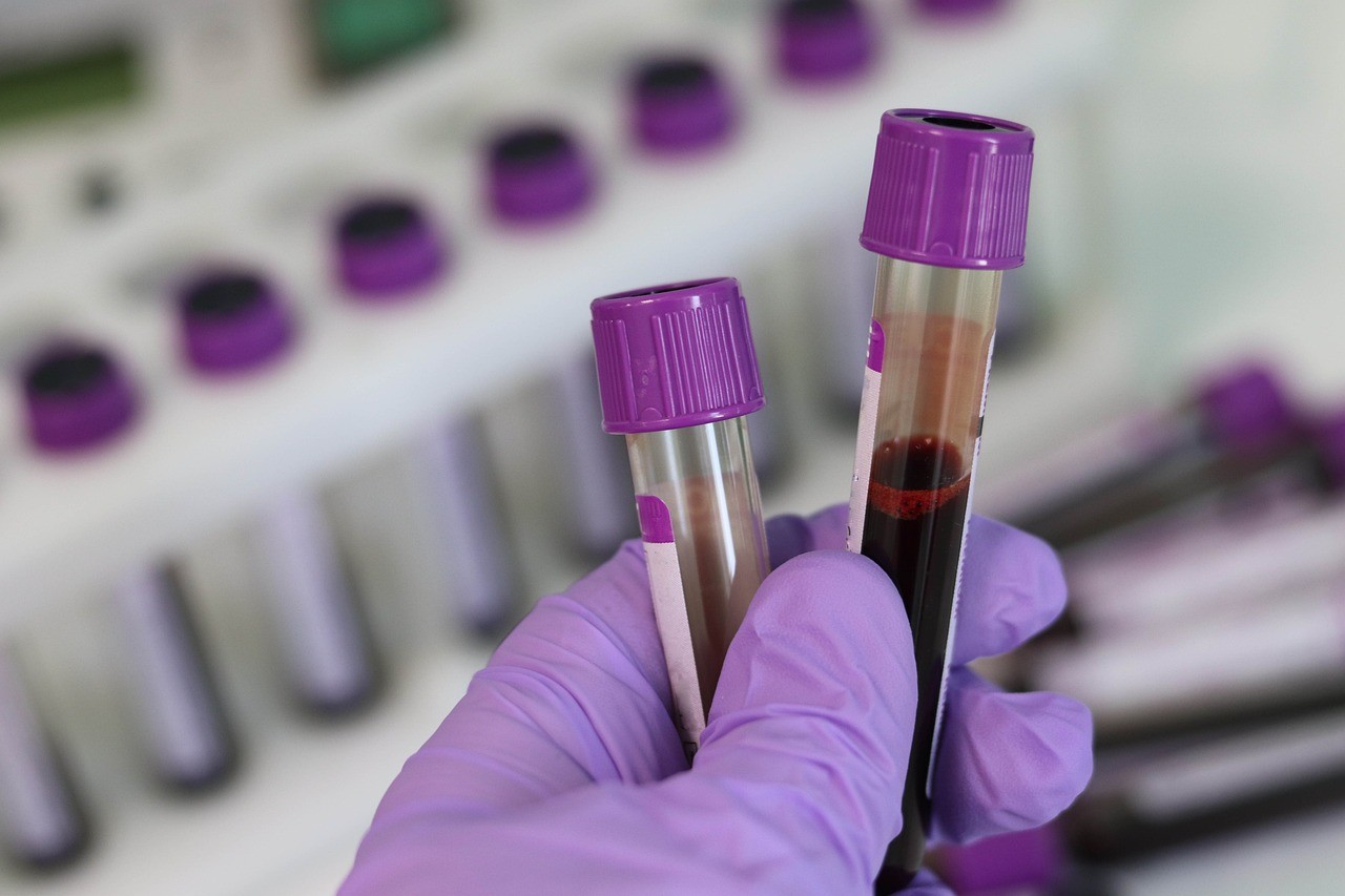 Blood samples are being kept safe in a pet laboratory