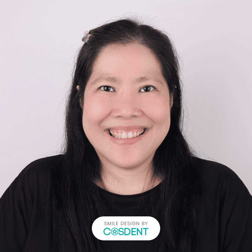 หน้ารูปลูกแพร์ ยิ้มกว้าง 16 ซี่