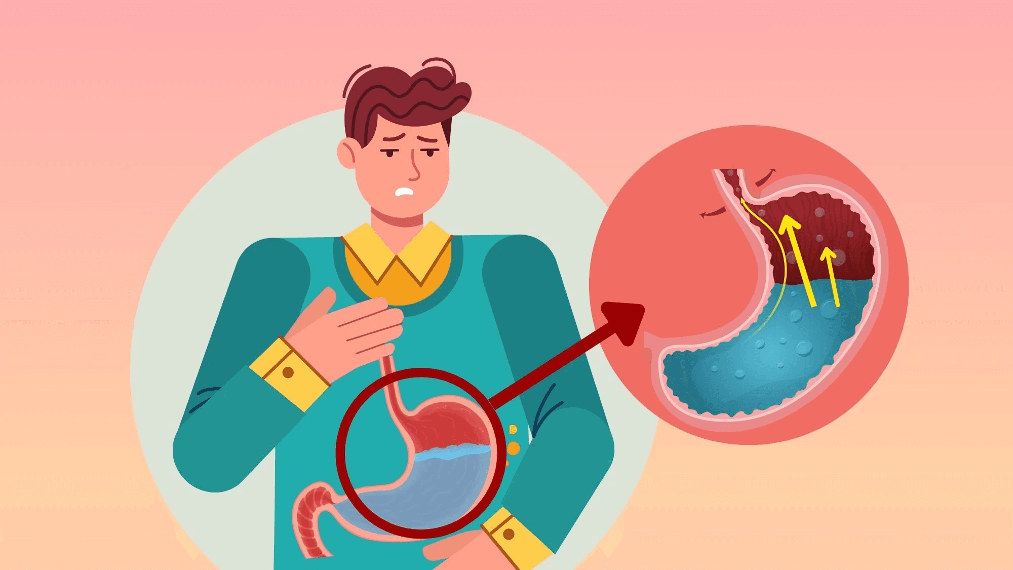 Does Semaglutide Cause Acid Reflux