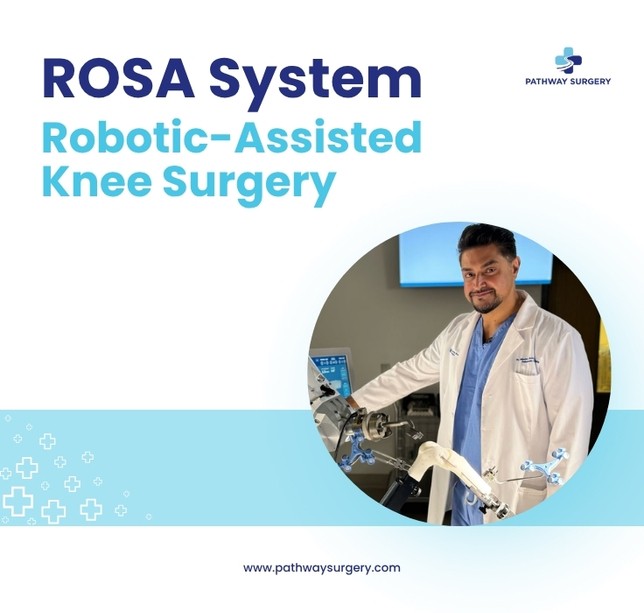 ROSA System For Robotic Knee Assisted Surgery Thumbnail.