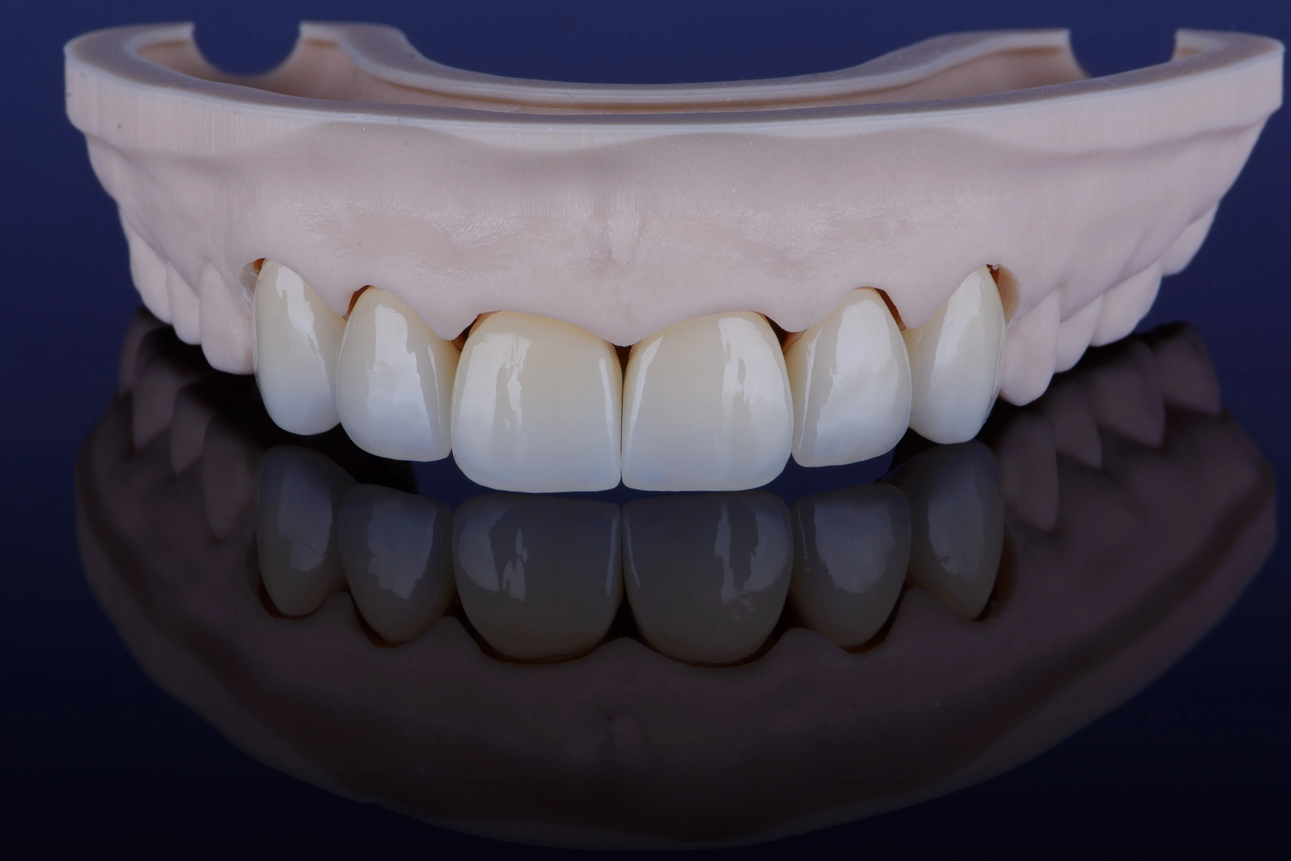 Fogászati Képzések - Egyfogú restaurációk új generációs anyagokból - PraxEvents