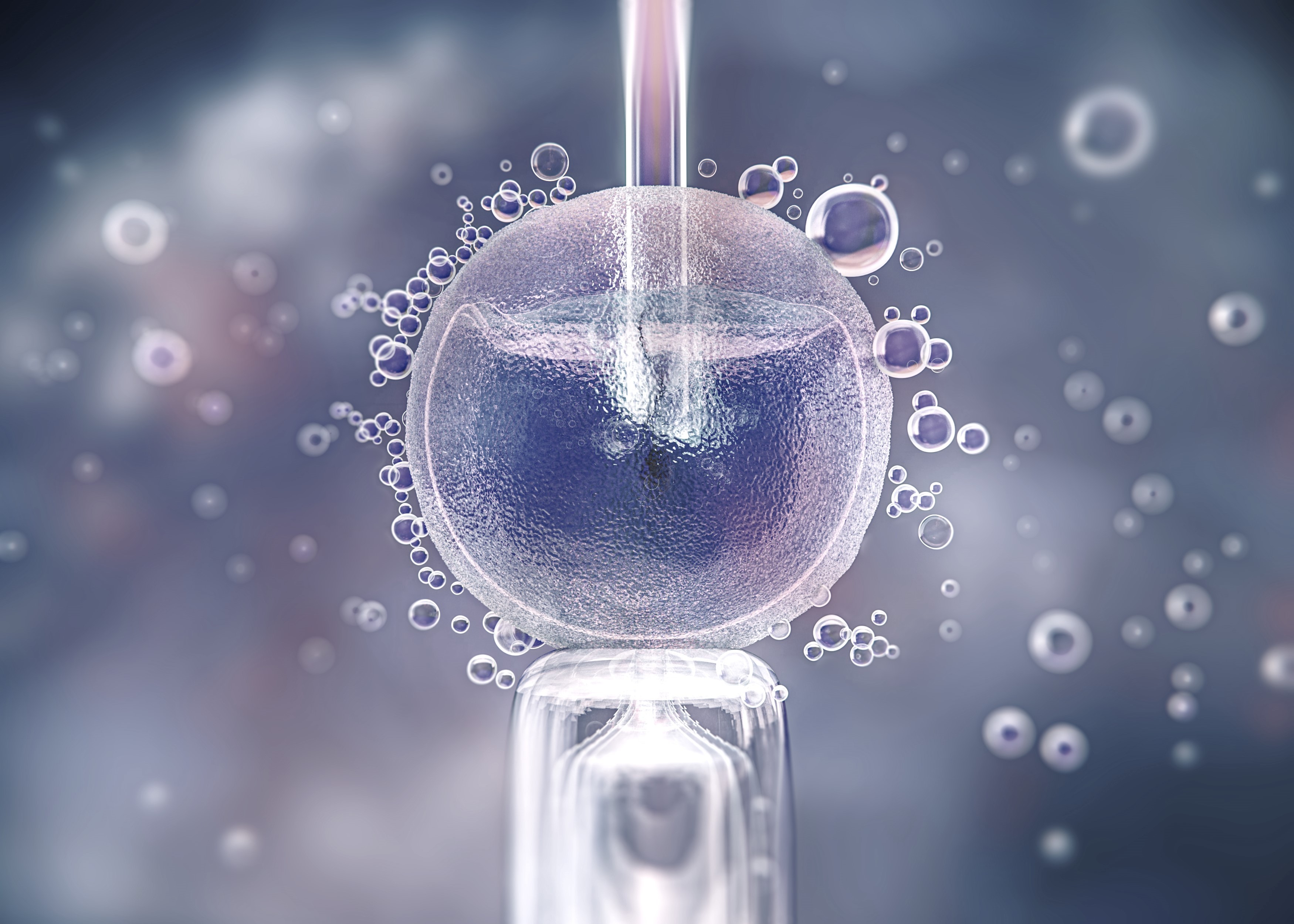Intracytoplasmic Sperm Injection (ICSI)
