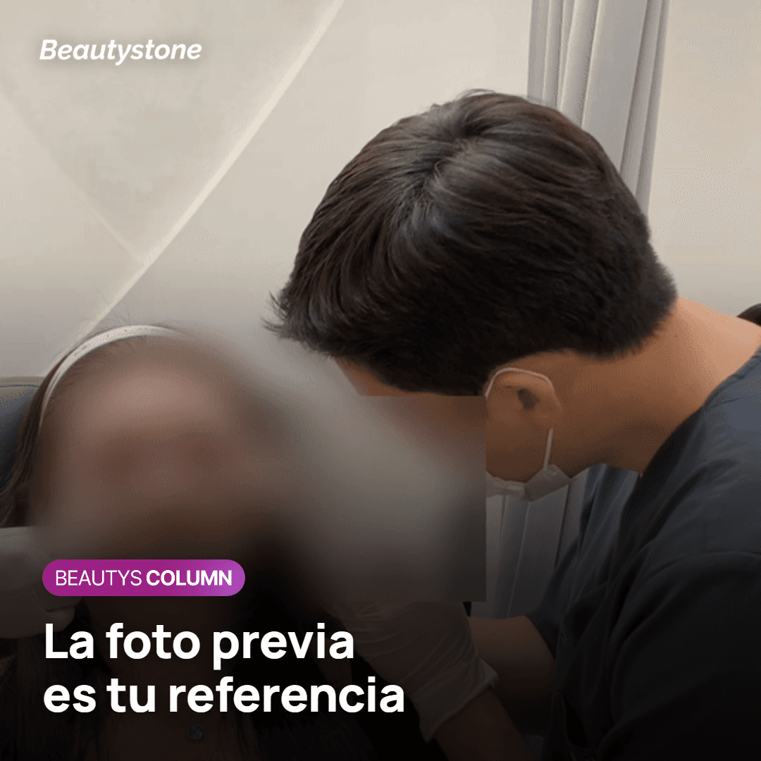 Fotos previas al tratamiento como línea de base para decidir la siguiente sesión