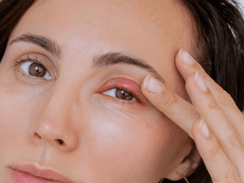 Vệ sinh da mặt một cách an toàn để không ảnh hưởng đến vùng mí