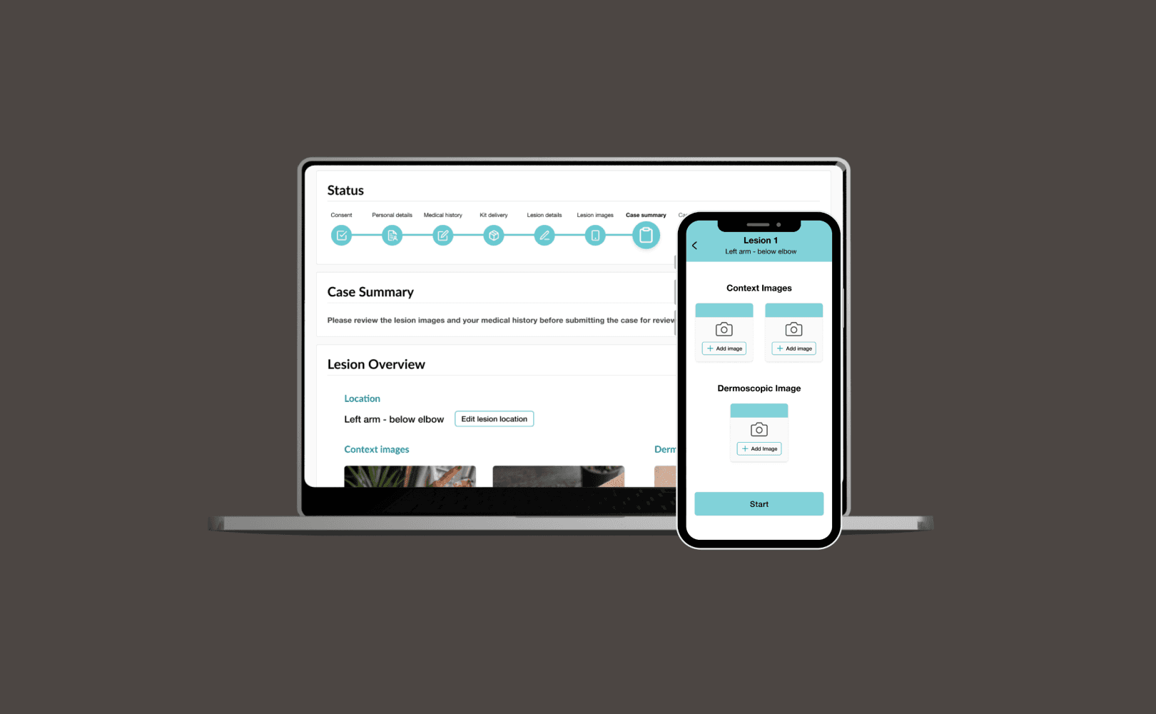 Case study hero image