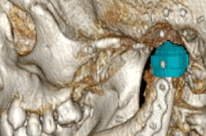 smiling happily caregiver hugging her old