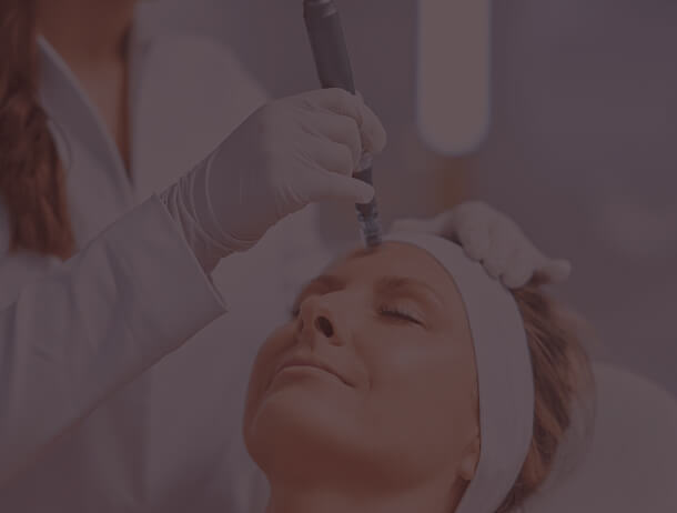 MICROAGULHAMENTO FACIAL
