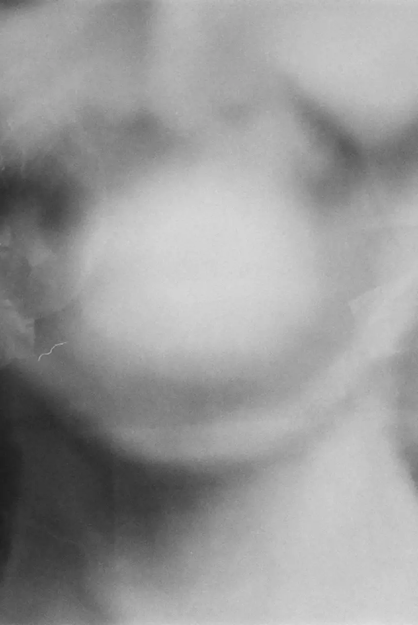 Jester's Privilege Mix