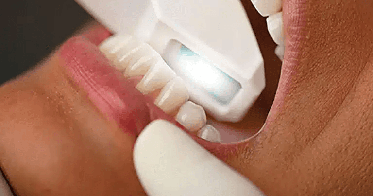 dental implant oral surgery