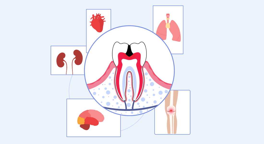 oral health and overall health
