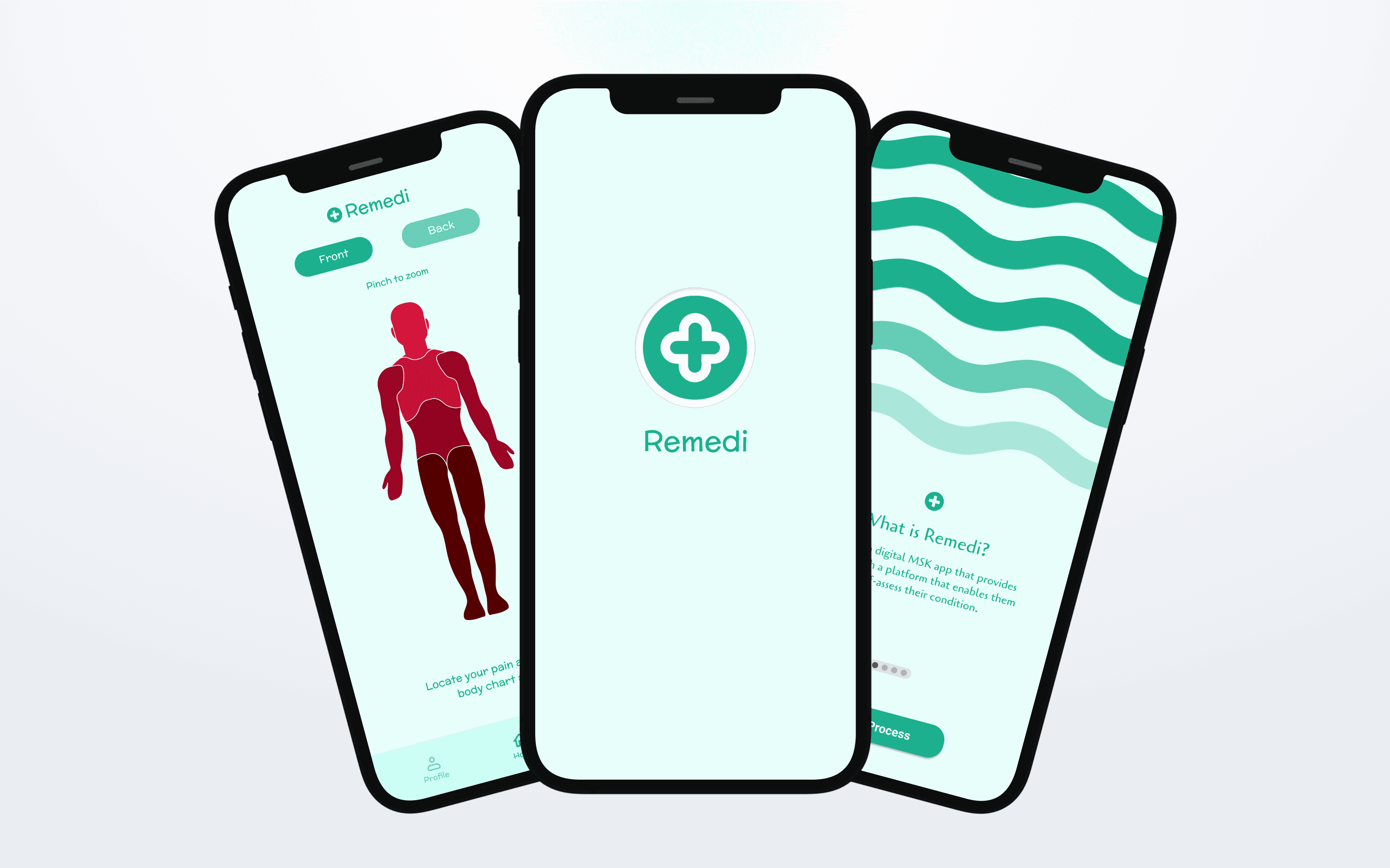 three phones showing Remedi app