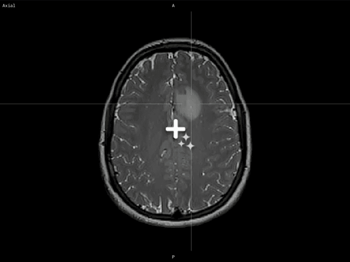 A DICOM annotation tool