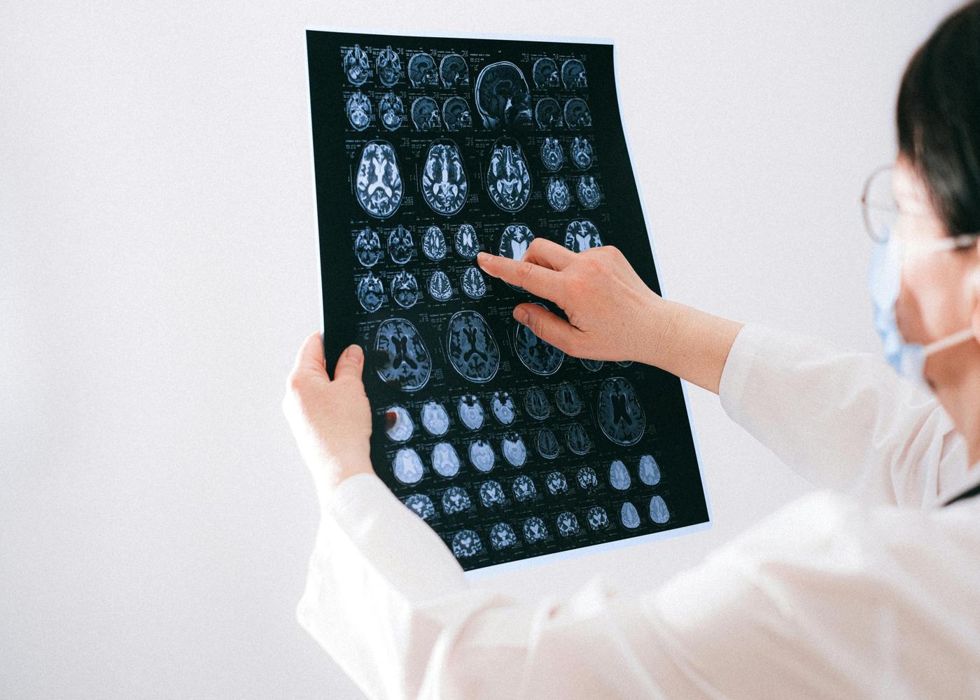 Doctor looking and pointing at a brain imaging scan