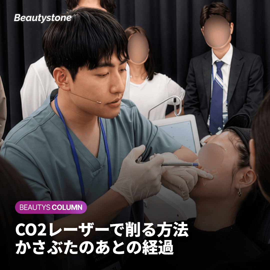 CO2レーザーで削る方法