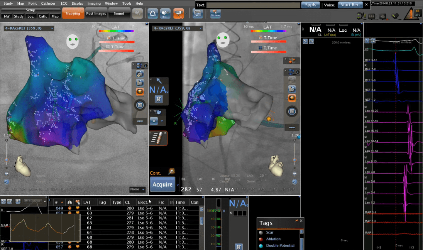 Example from Carto mapping system of a high-density monitoring interface
