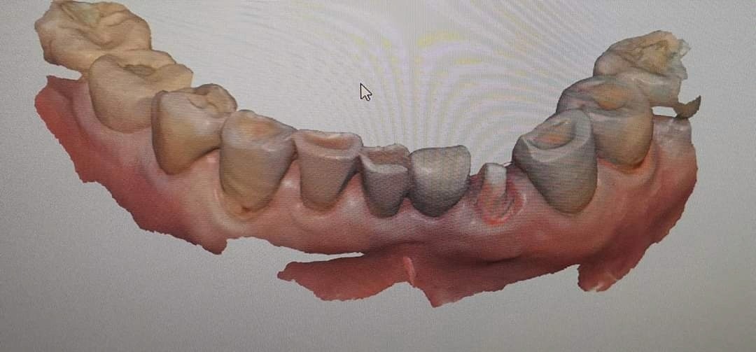역시 이정도케이스는 모델리스로
