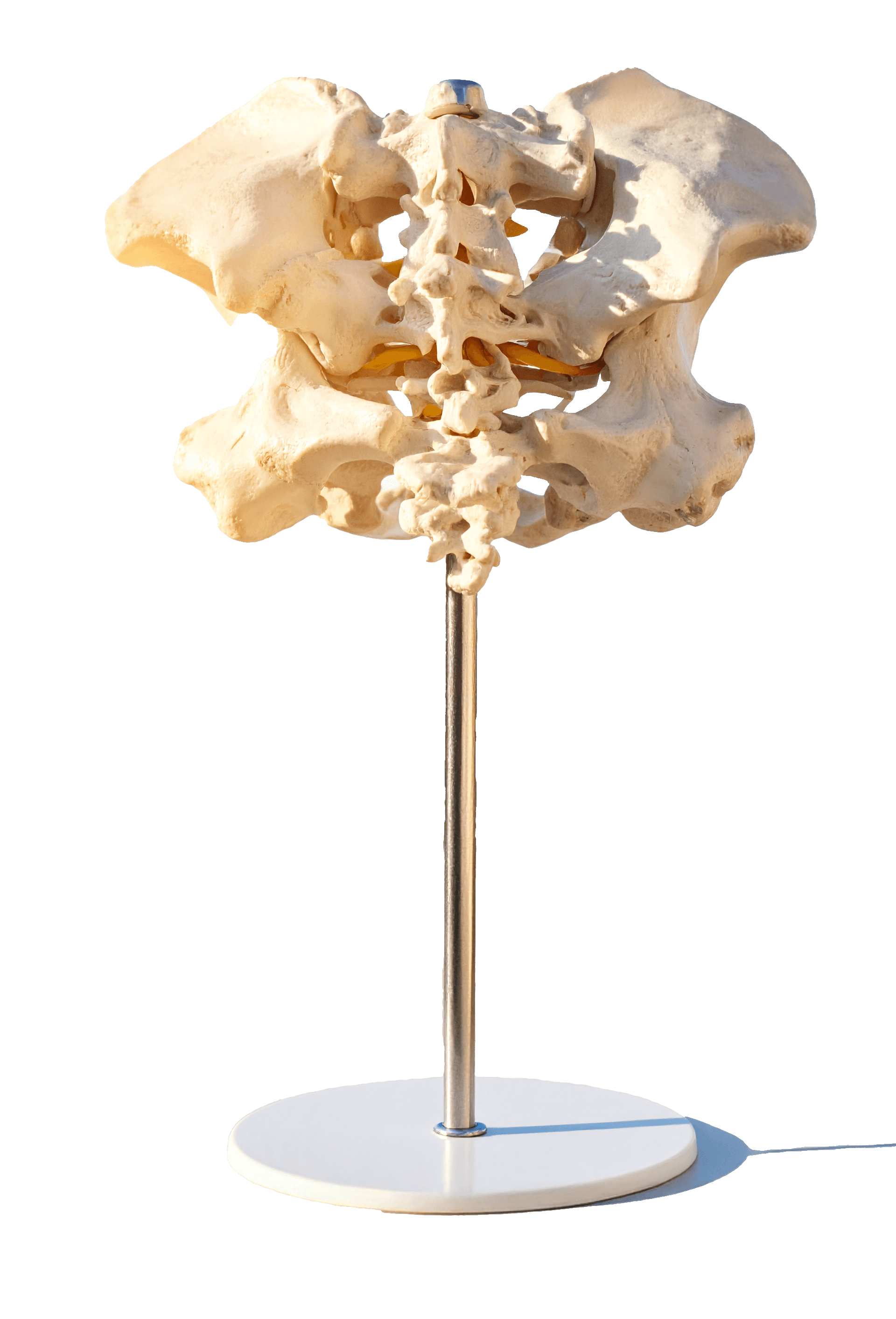 Atlas bone