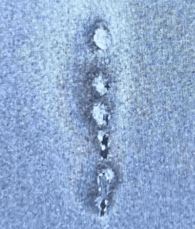 Pitting, streaking and cosmetic marks