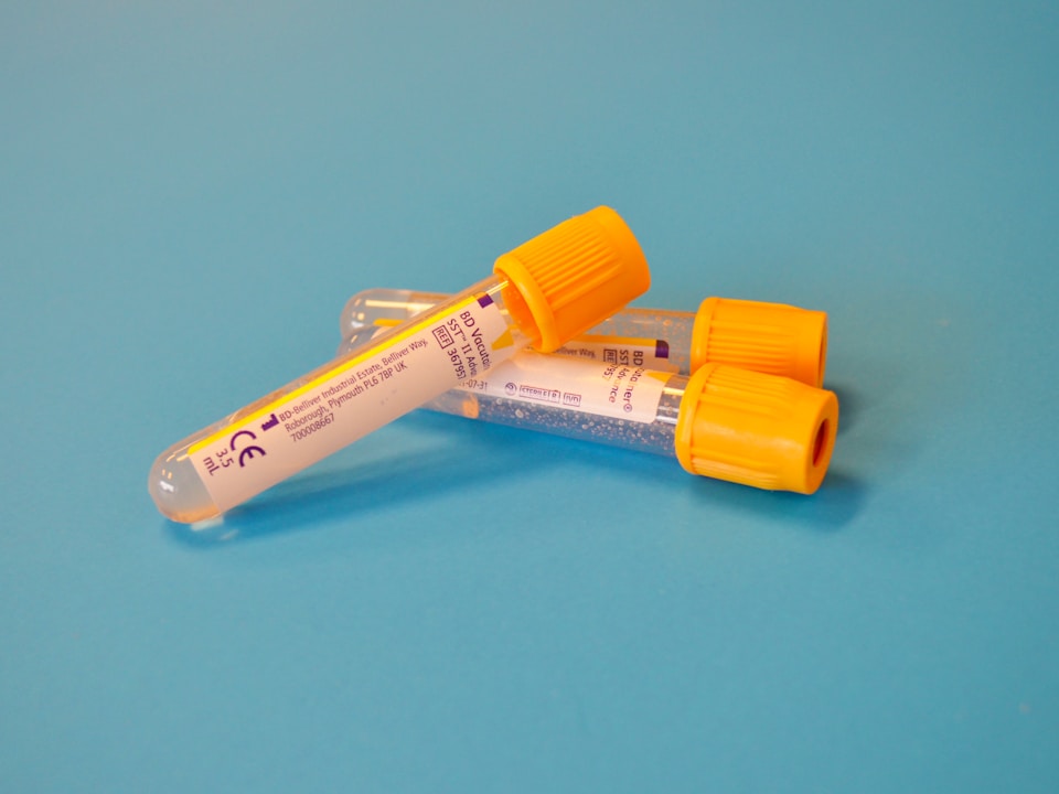 urine sample cup laboratory test