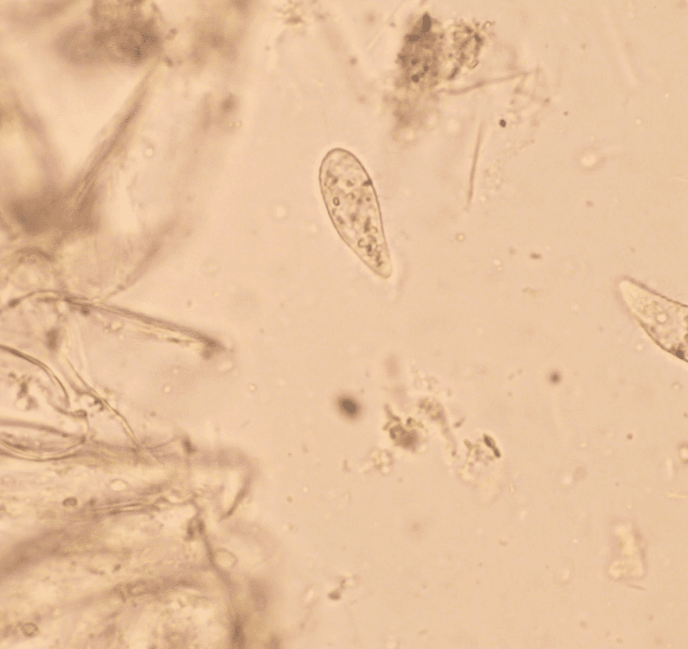 Dead copepod under microscope