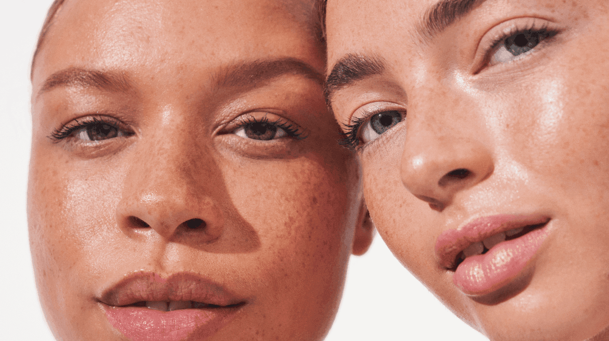 Before-and-after showing smoother skin texture.