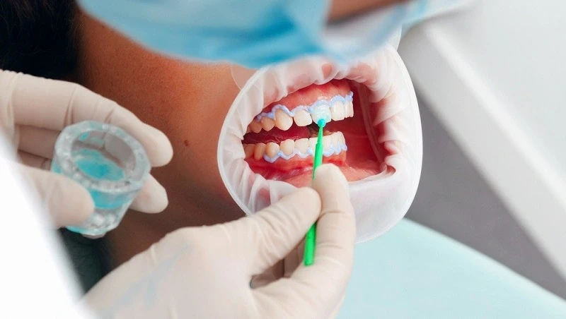 teeth whitening smyrna
