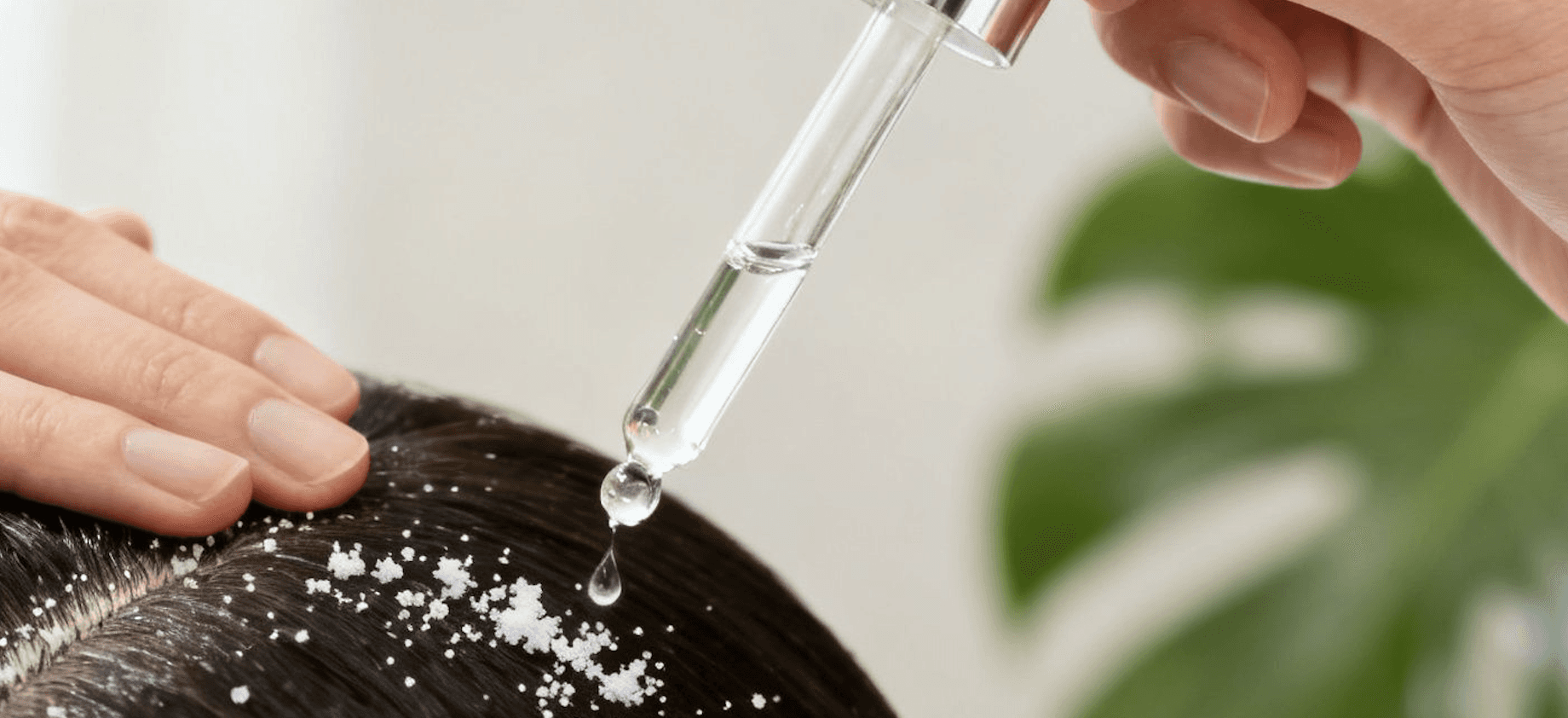 woman applying oil to dandruff